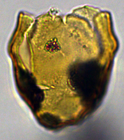 Hystrichosphaeridium tubiferum 4 Hcftub cac 27X2021350112b.jpg